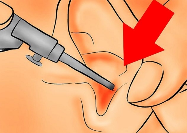 Закапывание лекарства в ухо