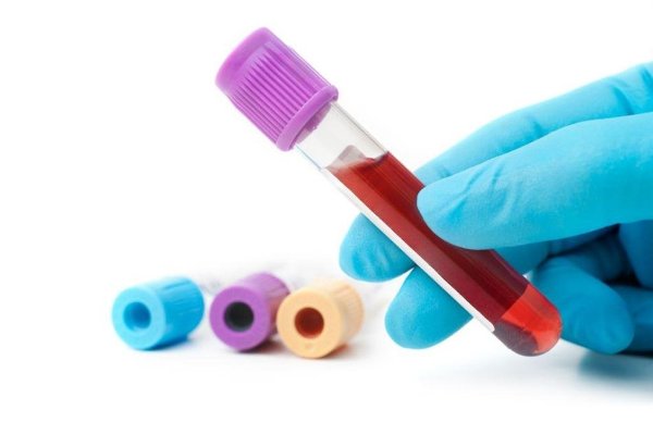 для диагностики плеврита нужно сдать общий и биохимический анализ крови