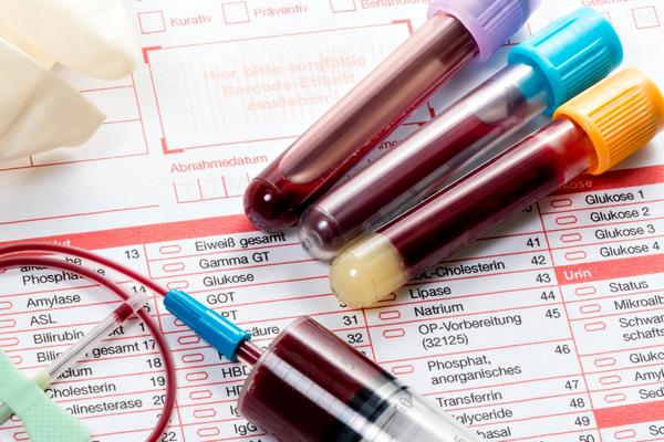анализ крови - один из методов диагностики туберкулеза